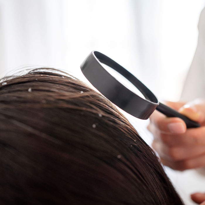 Doù viennent les pellicules dans les cheveux ?